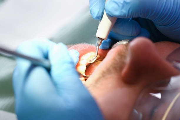 Best Urgent Tooth Repair  in Naples Park, FL
