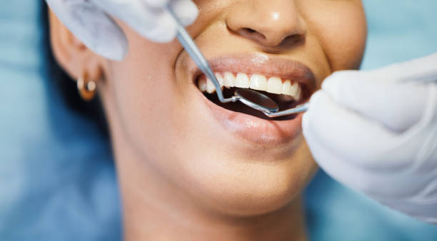 Best Urgent Tooth Repair  in Naples Park, FL